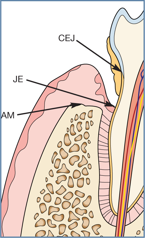 Figure 17