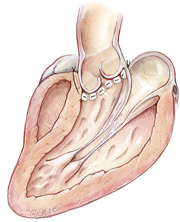 Figure 14