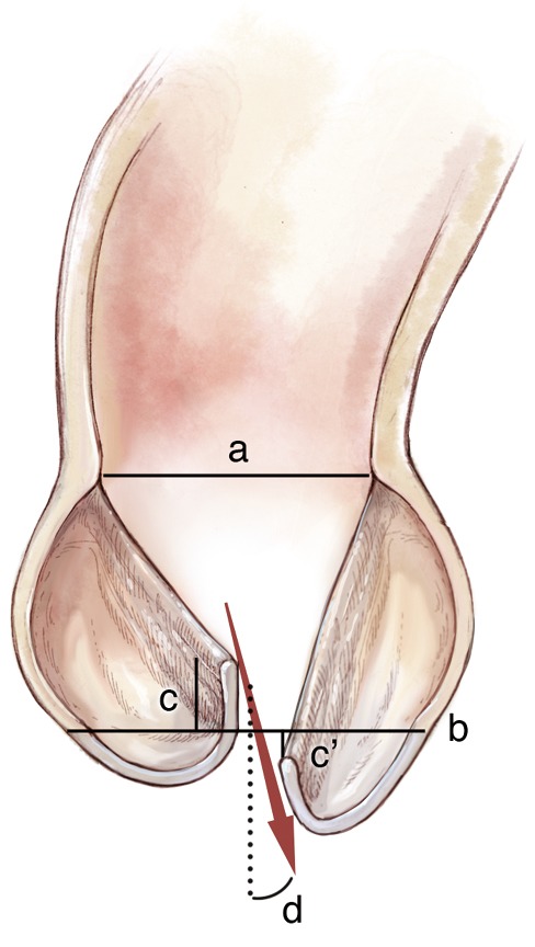 Figure 18