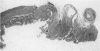 205