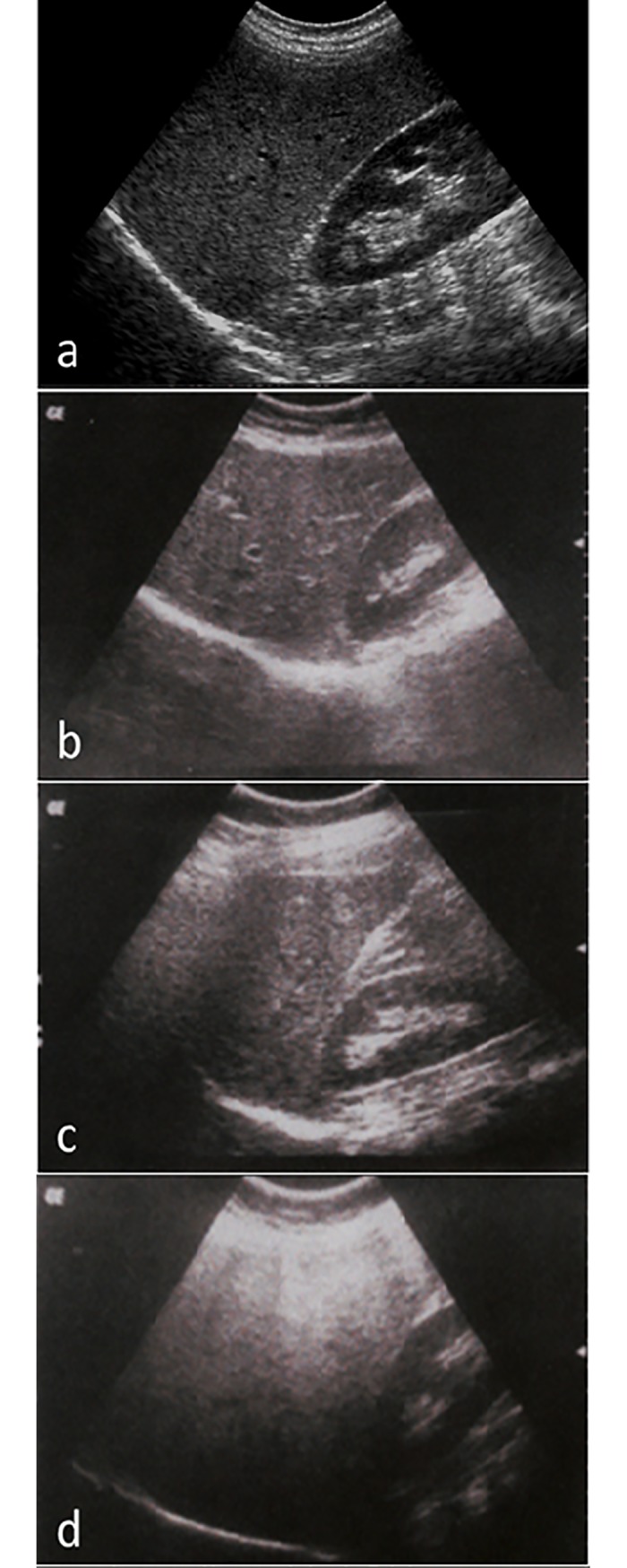 Fig 1