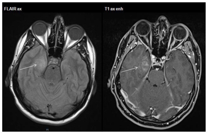 Figure 4A