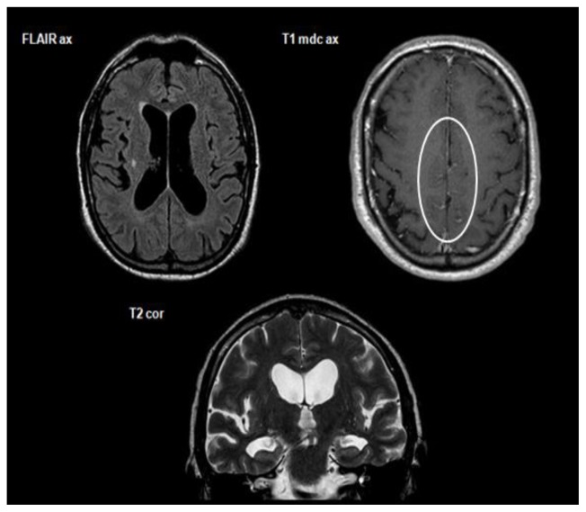 Figure 1B