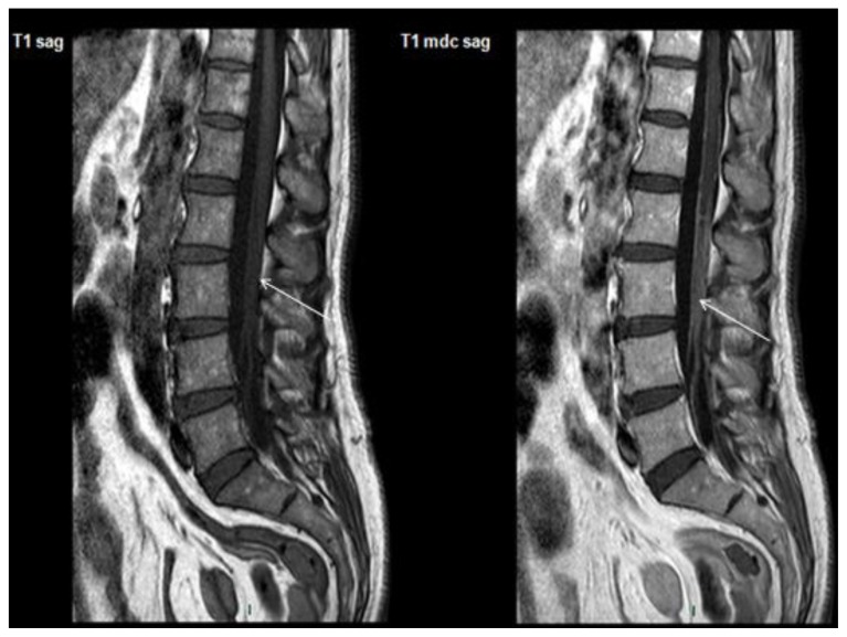 Figure 2A