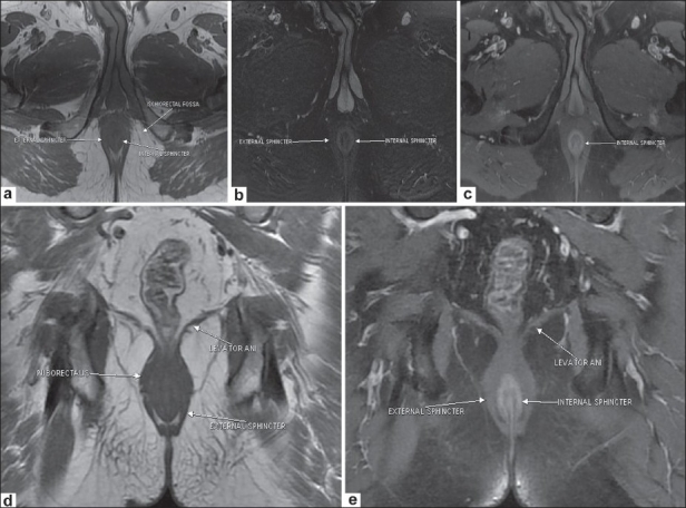 Figure 1 (a-e)