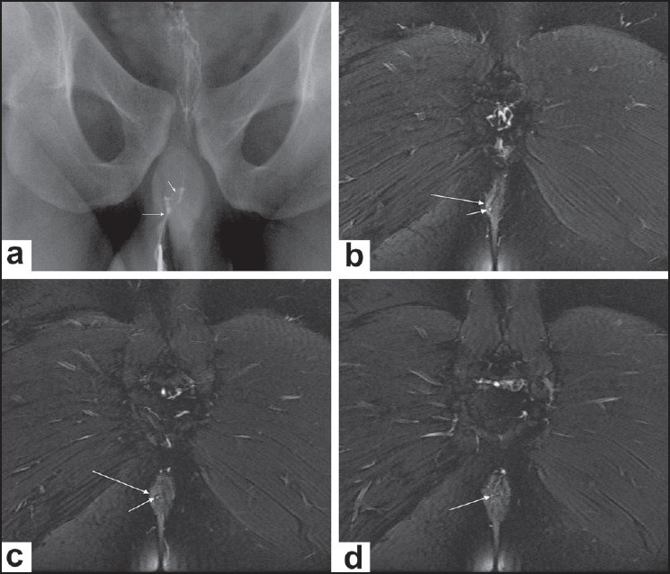 Figure 4 (a-d)