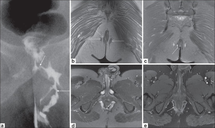 Figure 2 (a-e)