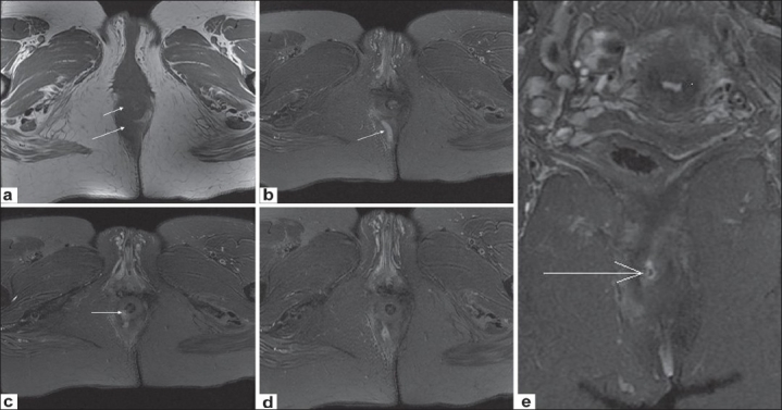 Figure 3 (a-e)