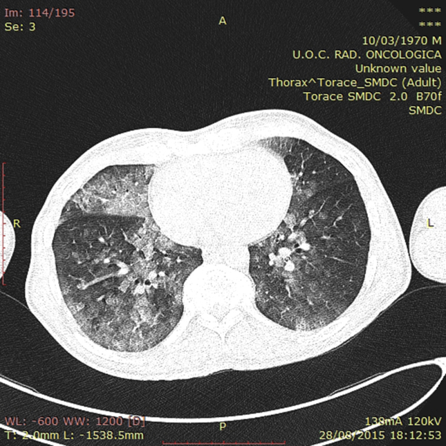 Fig. 1