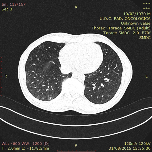 Fig. 2