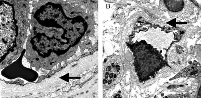 FIGURE 19