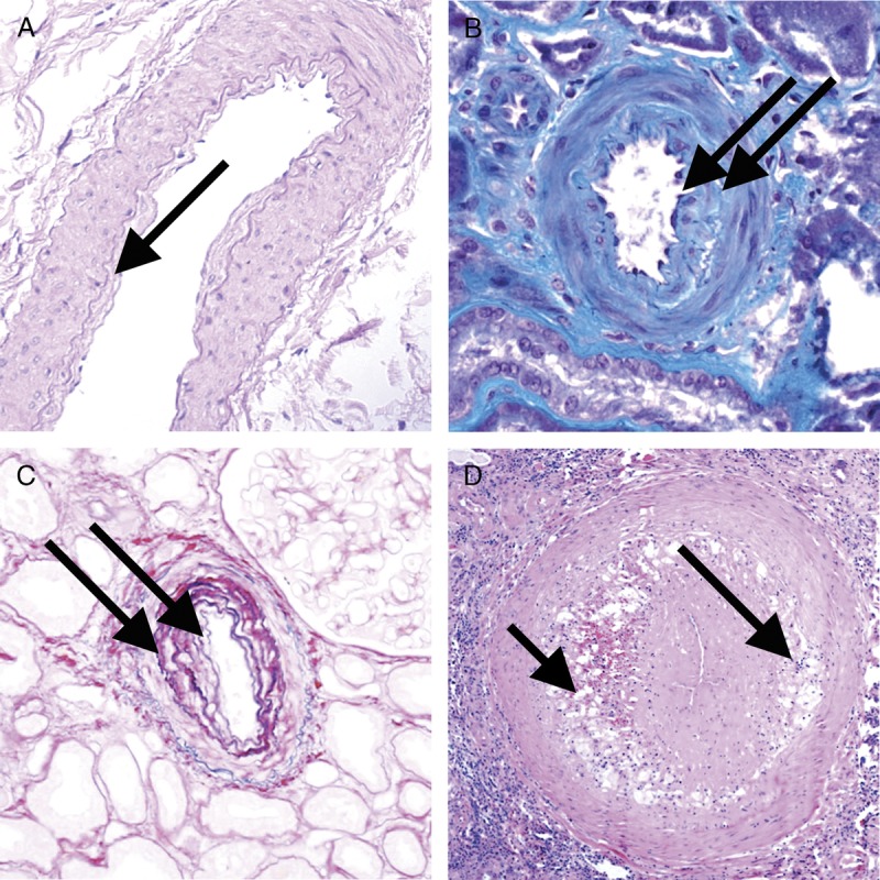 FIGURE 12