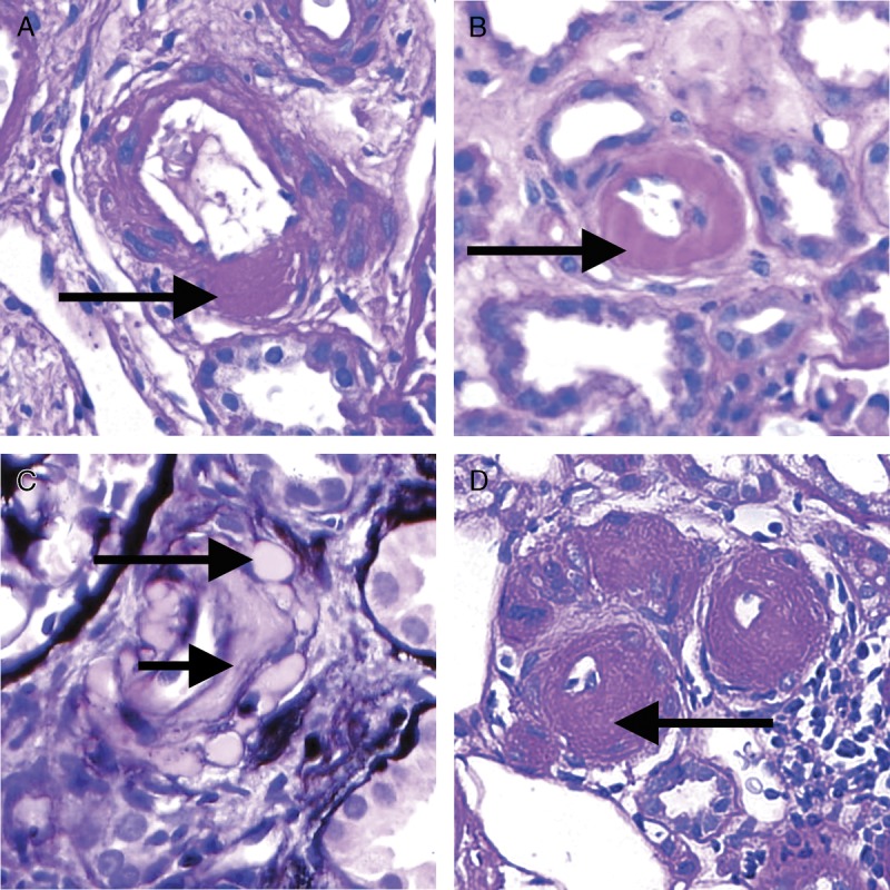 FIGURE 16