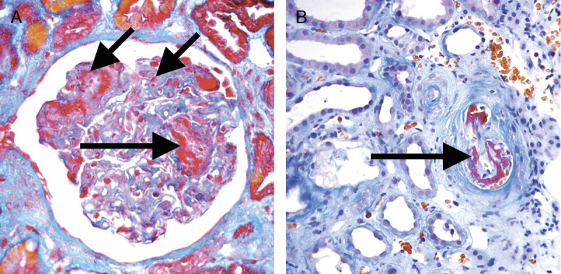 FIGURE 18