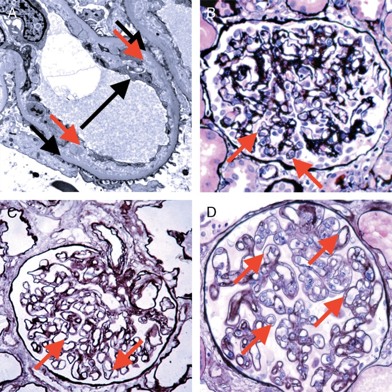 FIGURE 14