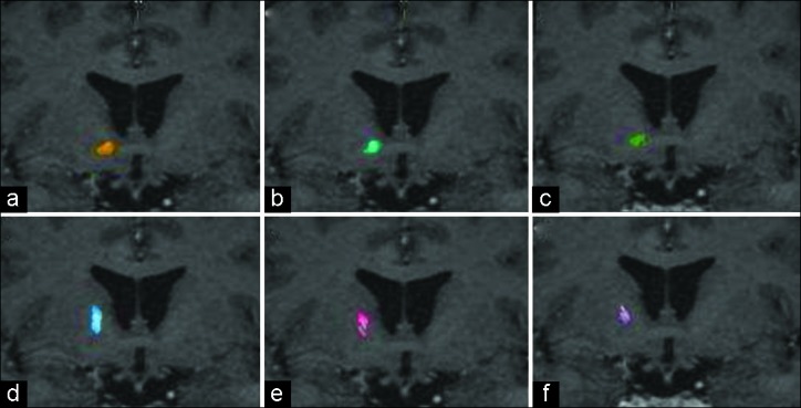 Figure 4: