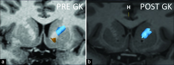 Figure 6: