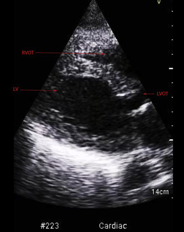 Supplemental Figure 3