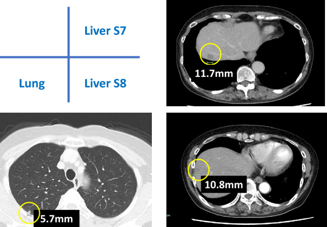 Fig. 1