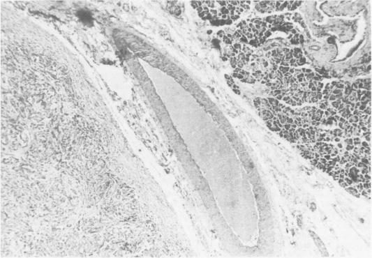 Fig. 1b.