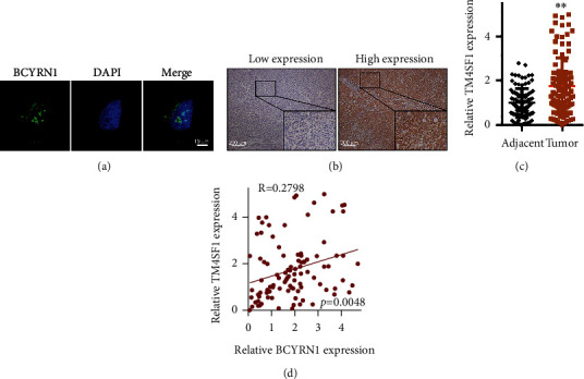 Long Noncoding Rna Bcyrn1 Recruits Batf To Promote Tm4sf1 Upregulation 