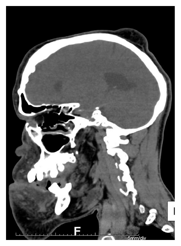 Figure 14