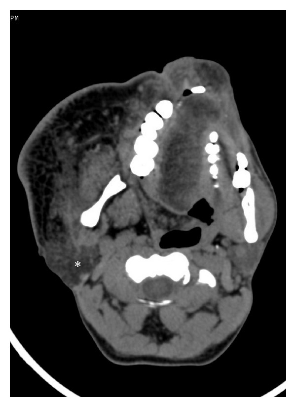 Figure 12