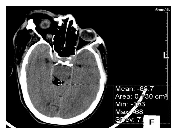 Figure 11