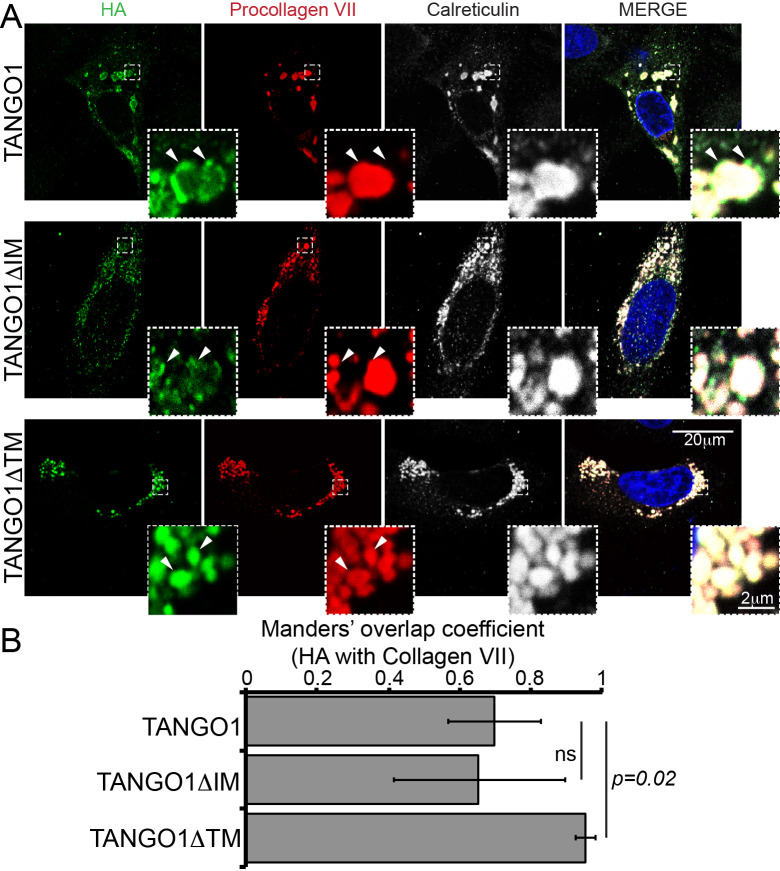 Figure 3—figure supplement 1.