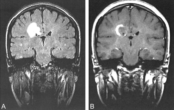 fig 2.