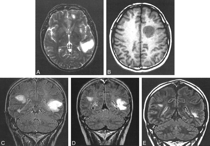 fig 3.