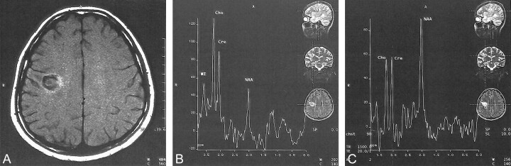 fig 5.