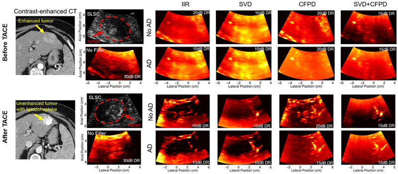 Fig. 12.