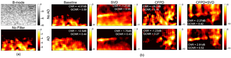 Fig. 11.