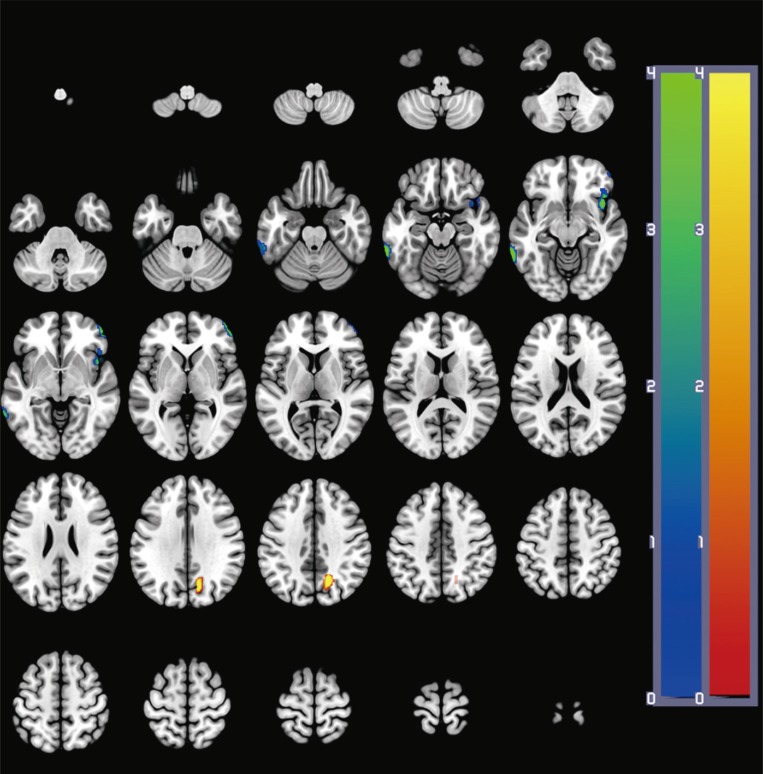 Fig. 1