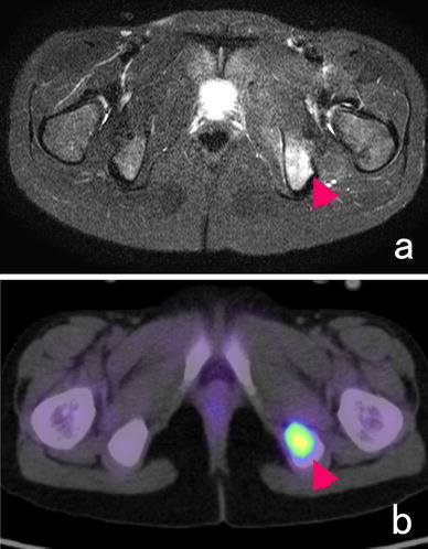 Fig. 4