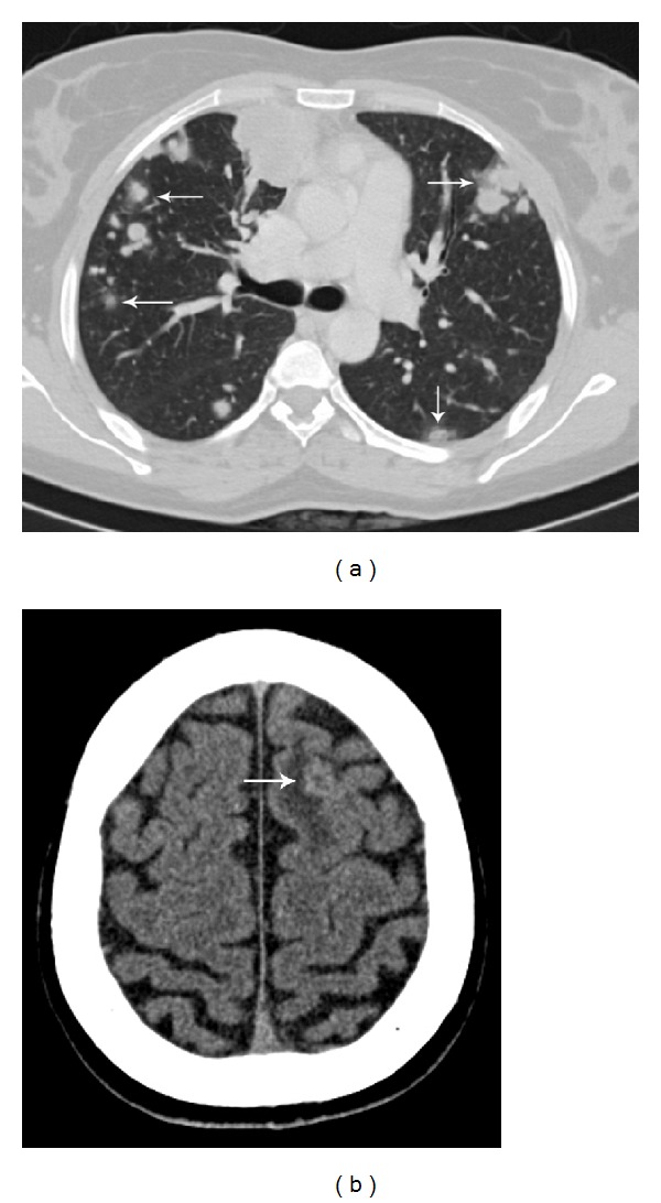 Figure 13