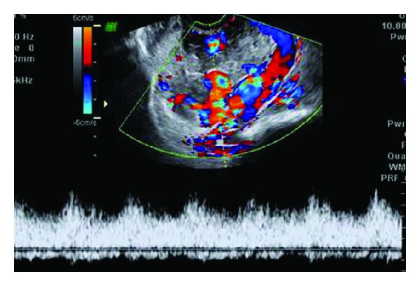 Figure 4