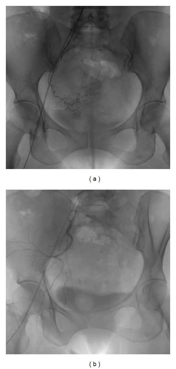 Figure 12