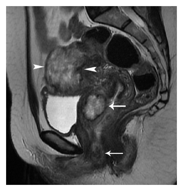 Figure 14