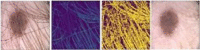 Fig 7