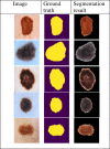Fig 10