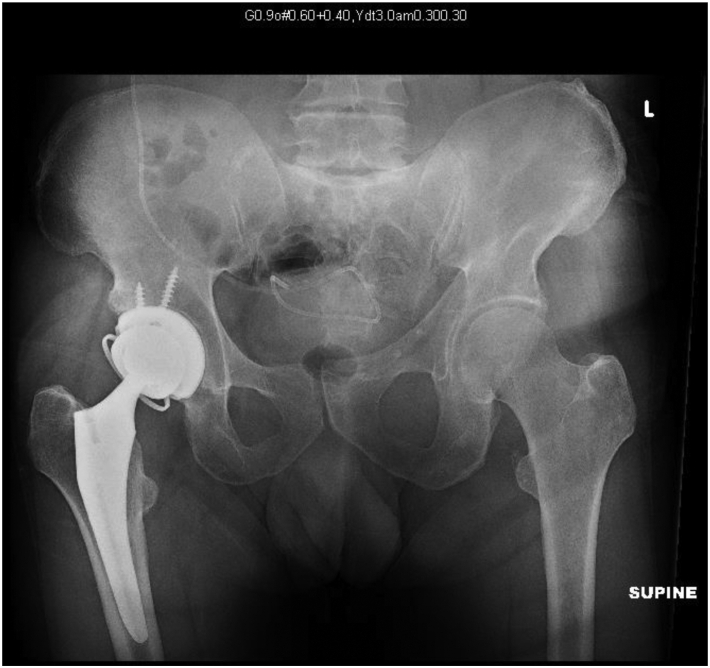 Figure 4