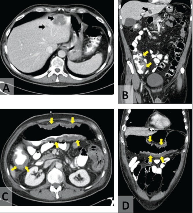 Figure 2)