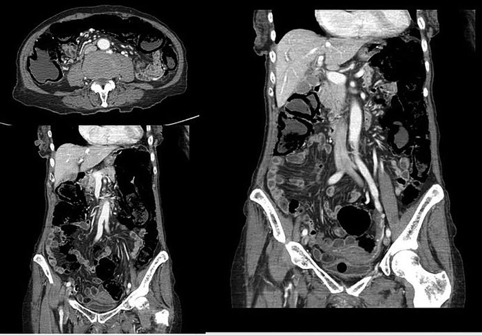 Figure 2