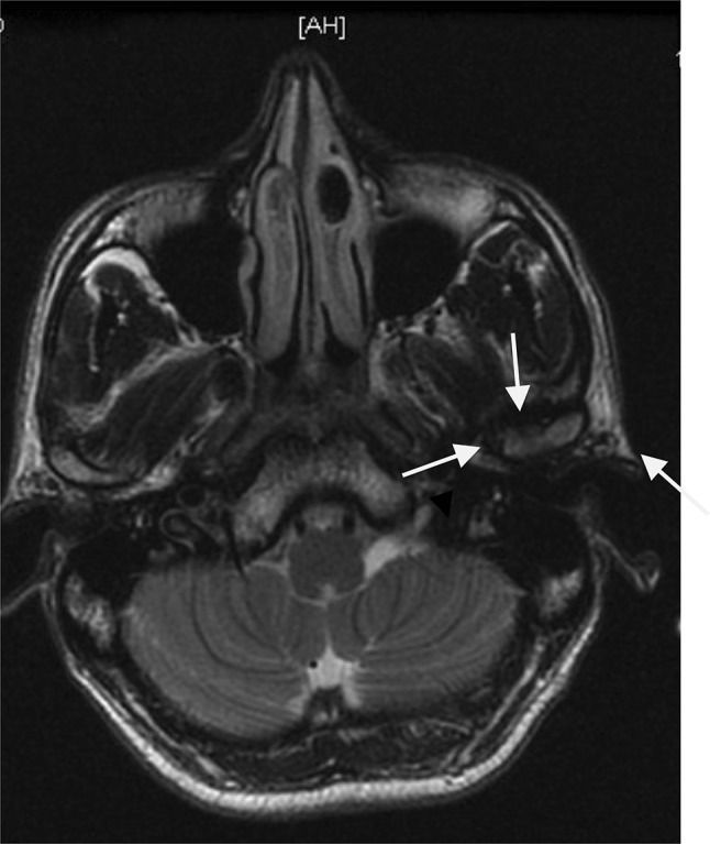 Fig. 4