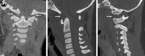 Figure 21