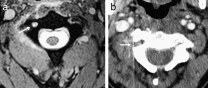 Figure 25