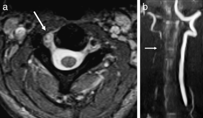 Figure 24