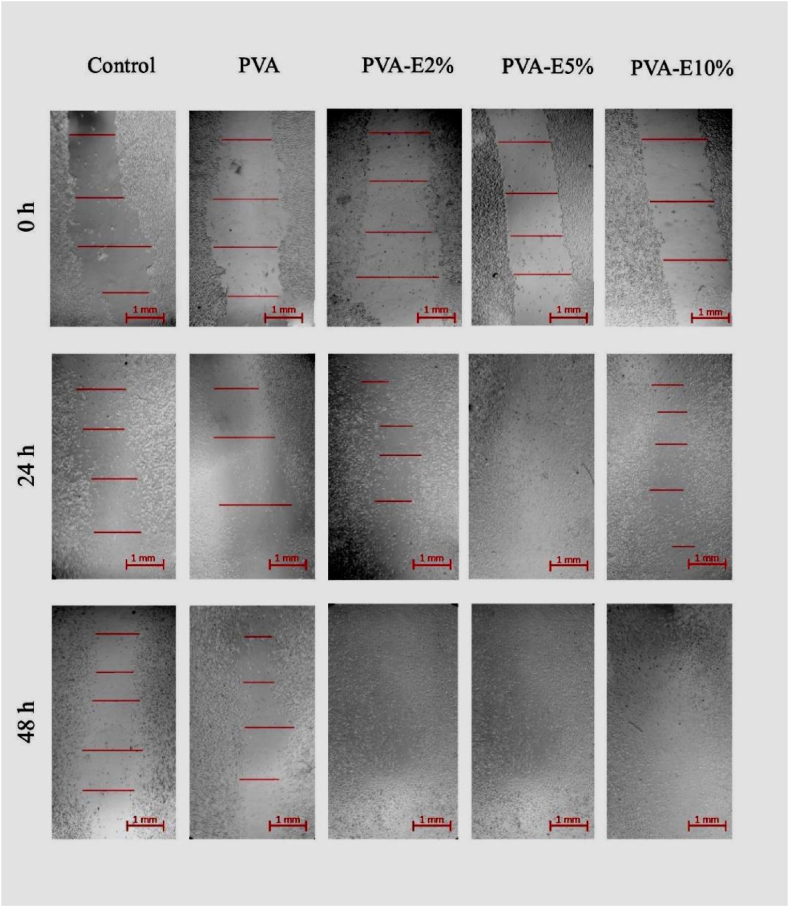 Fig. 12
